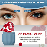 Silicone Facial Ice Globe